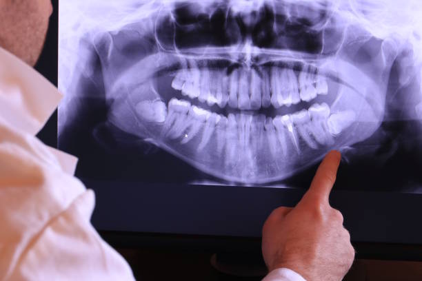 Best Emergency Tooth Extraction in Kenilworth, PA